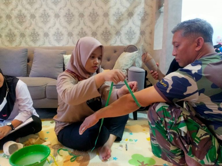 Tangan Prostetik Sang Prajurit Pejuang Segera Selesai, Tahan 8 Tahun