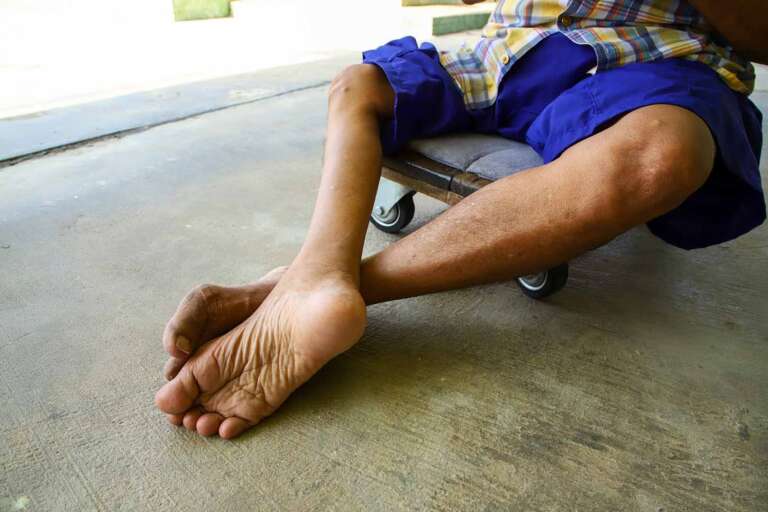 Alami Evolusi, Pakar: Terdeteksi Sejak Peradaban Mesir Kuno, Perlu Penanganan Holistik!