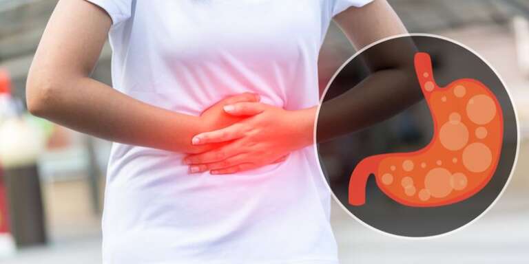 Apa Perbedaan Gerd dengan Asam Lambung dan Bagaimana Cara Mengatasinya?