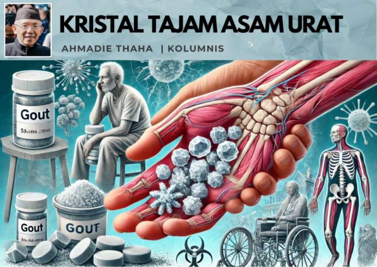 Kristal Tajam Asam Urat