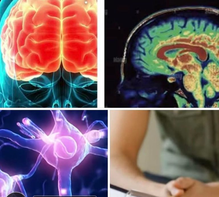 Esai Ramadan (4): Terapi Psiko-Neurobiologi Dalam Praktik Puasa